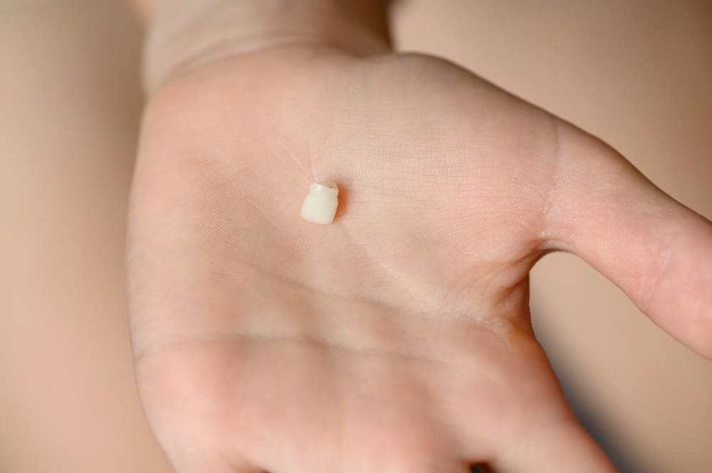 Een melktand in een kinderhand