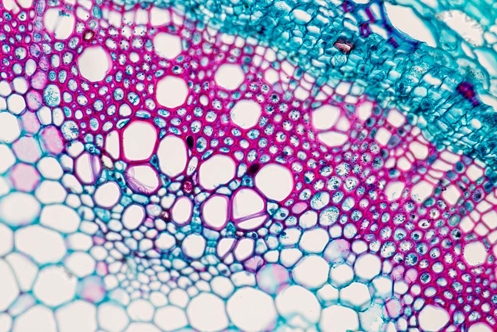 Dwarsdoorsnede van een plantenstengel onder de microscoop